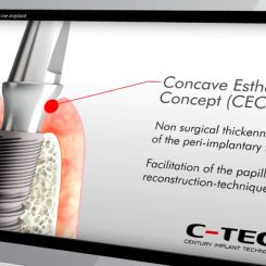 C-Tech – EL Esthetic Line Implant